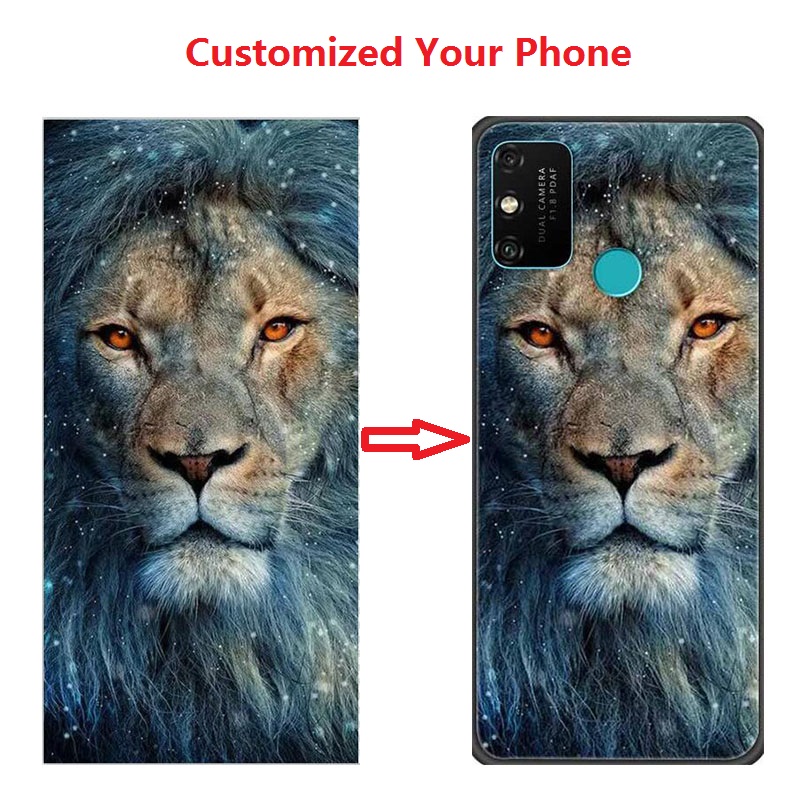 Vivo X200 - Customized DIY Phone Case For Vivo